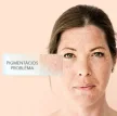Schüssler natúr arckrém pigmentációs problémákra Nr.6  - 75 ml