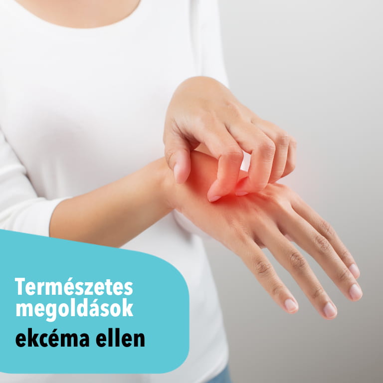 Természetes megoldások ekcéma kezelésére - otthoni gyógymódok