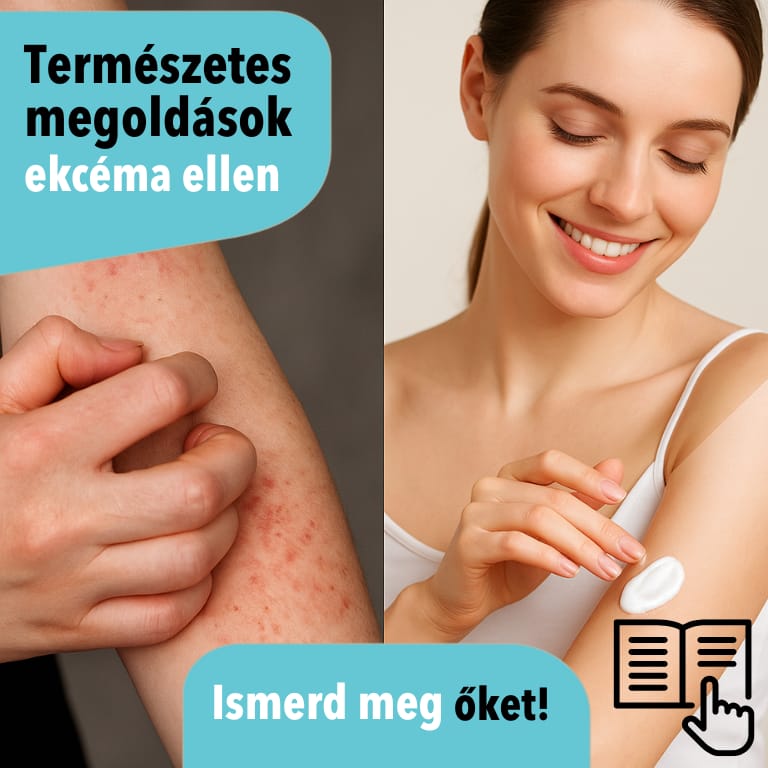 Természetes megoldások ekcéma kezelésére - otthoni gyógymódok